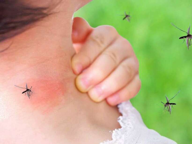 Еве зошто некои луѓе се магнет за комарци, а други ги избегнуваат!