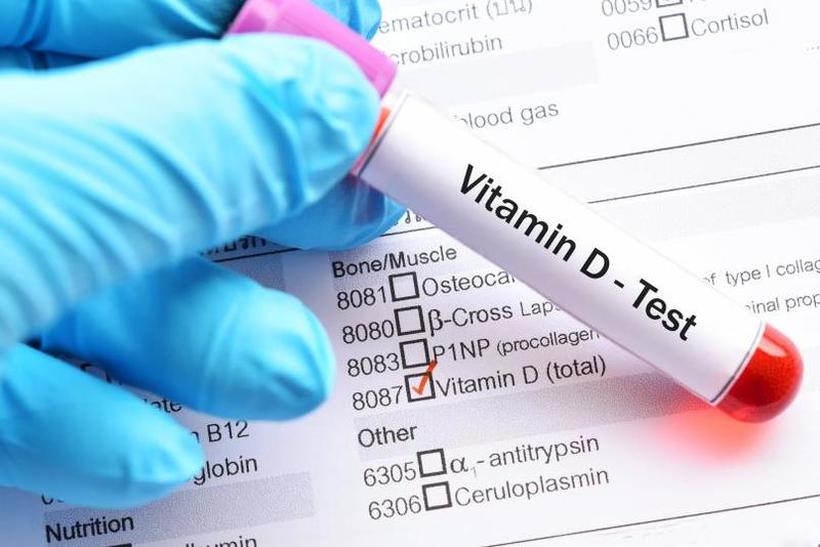 Недостатокот на витамин Д во организмот предизвикува потежок облик на COVID-19