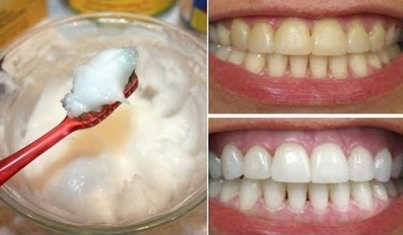 Од овие две состојки кои сигурно ги имате дома може да направите природна смеса за избелување на забите