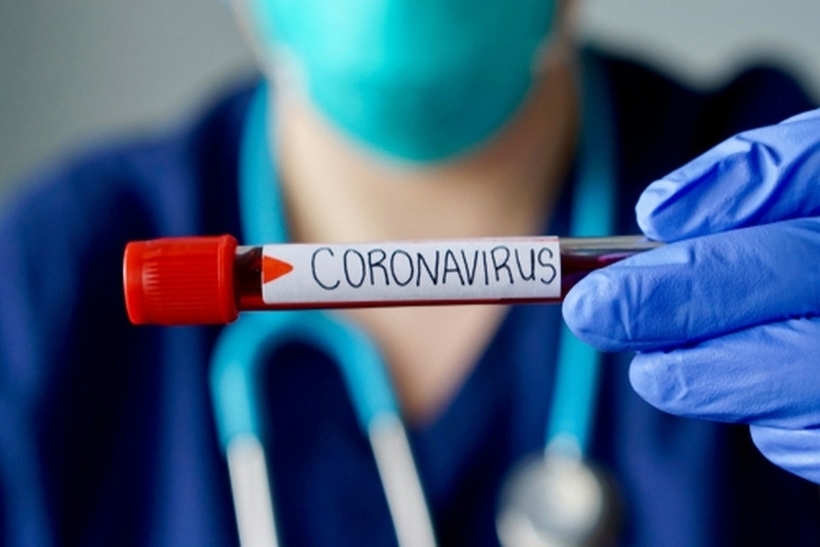 Наместо 50 евра тестот за коронавирус за невработени во Србија ќе биде бесплатен