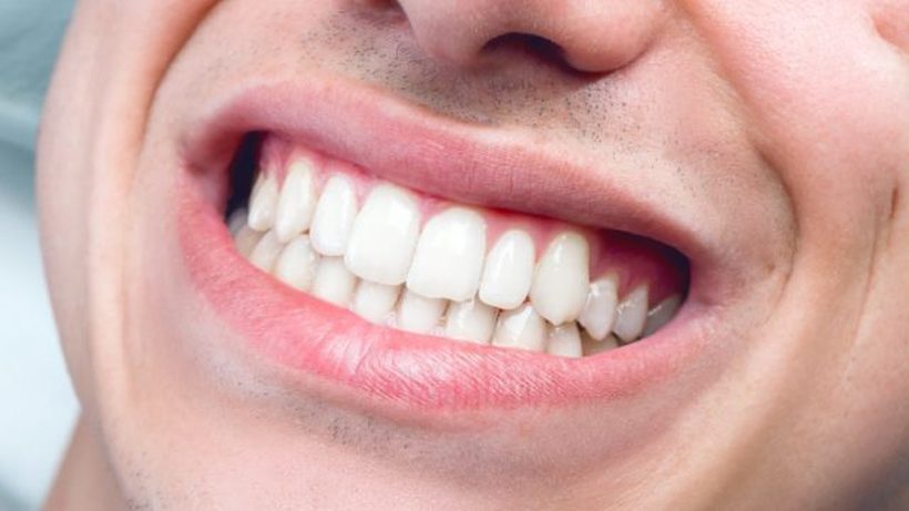 Колку заби сте изгубиле досега? – Тоа кажува колку долго ќе живеете