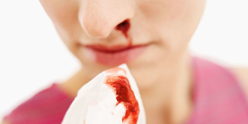Што значи изненадното течење на крв од носот?