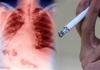 Спас за пушачите: Две намирници ги враќаат белите дробови во живот , но само ако ги јадете секој ден - а чинат помалку од кутија цигари
