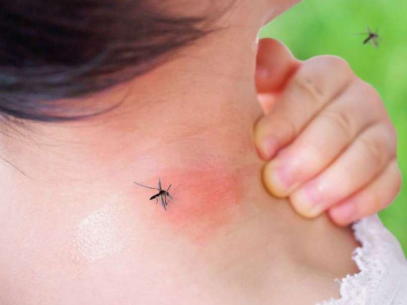 3 проверени трикови кои делуваат за СПАС од комарците
