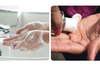 Сапун или средство за дезинфекција: Што е поштетно за кожата на рацете