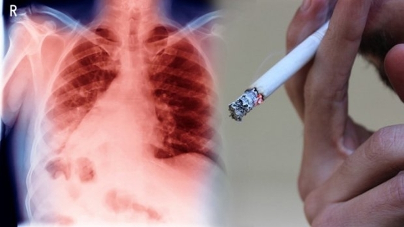 Колку години им се потребни на срцето и белите дробови да закрепнат по откажувањето од пушење?